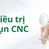 mun-cnc-gold-nb
