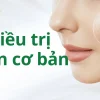 mun-co-ban-gold-ninh-binh