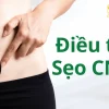 seo-cnc-gold-nb