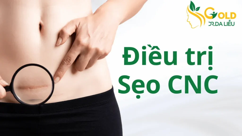 seo-cnc-gold-nb
