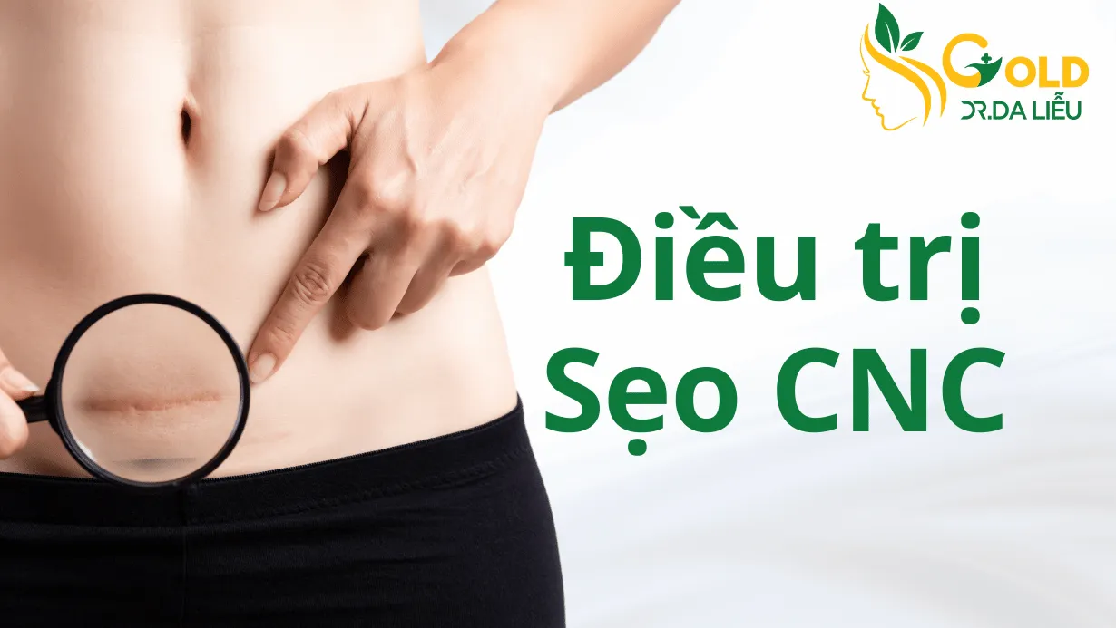 seo-cnc-gold-nb