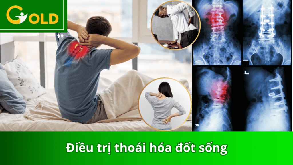 dieu-tri-thoai-hoa-dot-song