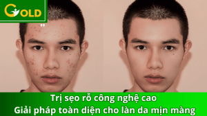 tri-seo-ro-xong-nghe-cao