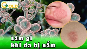 cham-soc-da-khi-nam-mat