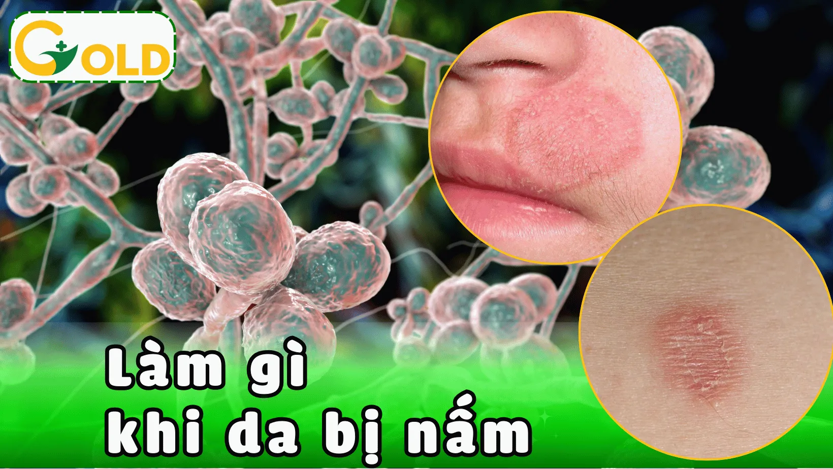 cham-soc-da-khi-nam-mat