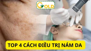 Bệnh nám da mặt và cách Bệnh nám da mặt và cách điều trị